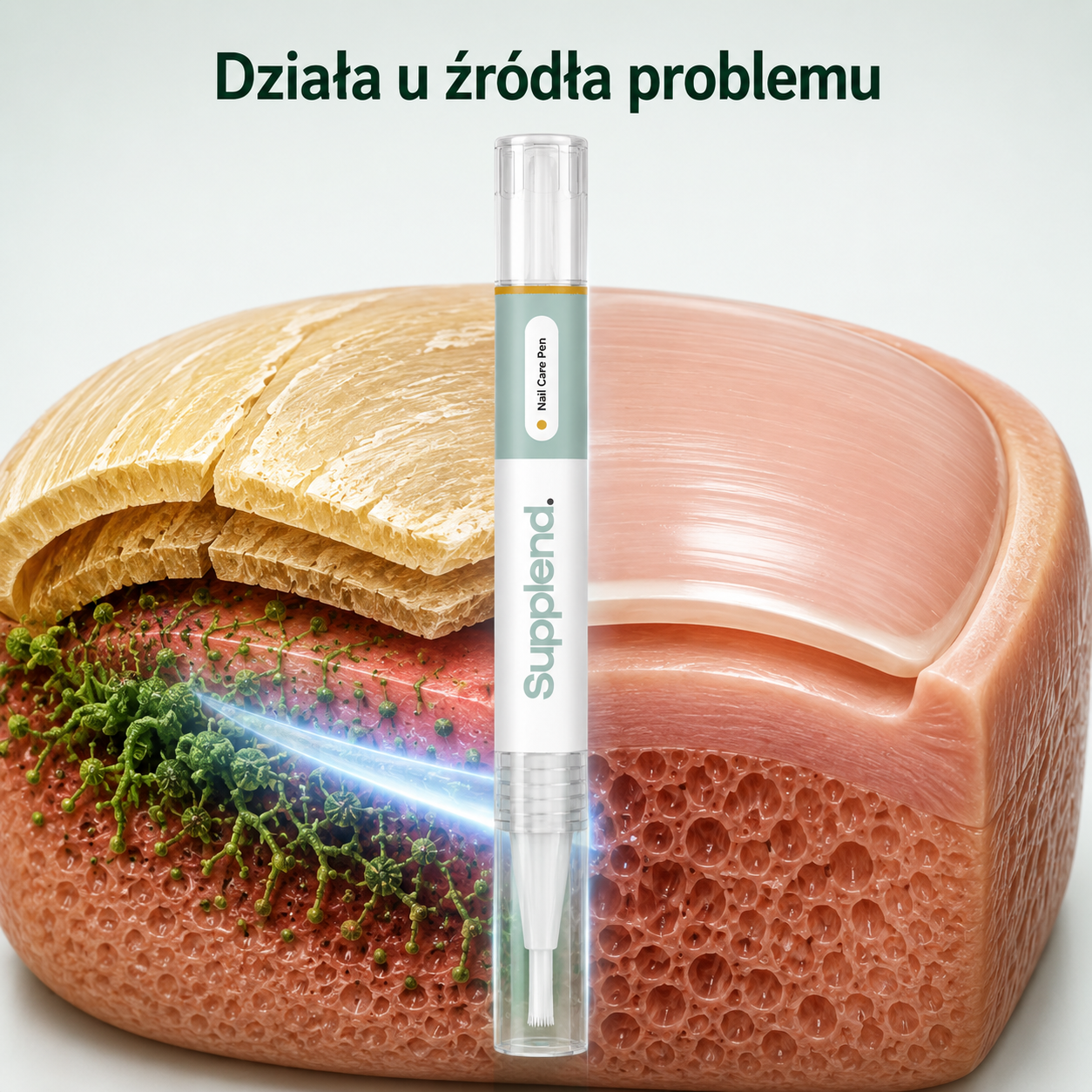 Supplend™ | Pożegnaj Grzybicę Paznokci I Odzyskaj Zdrowe, Piękne Paznokcie
