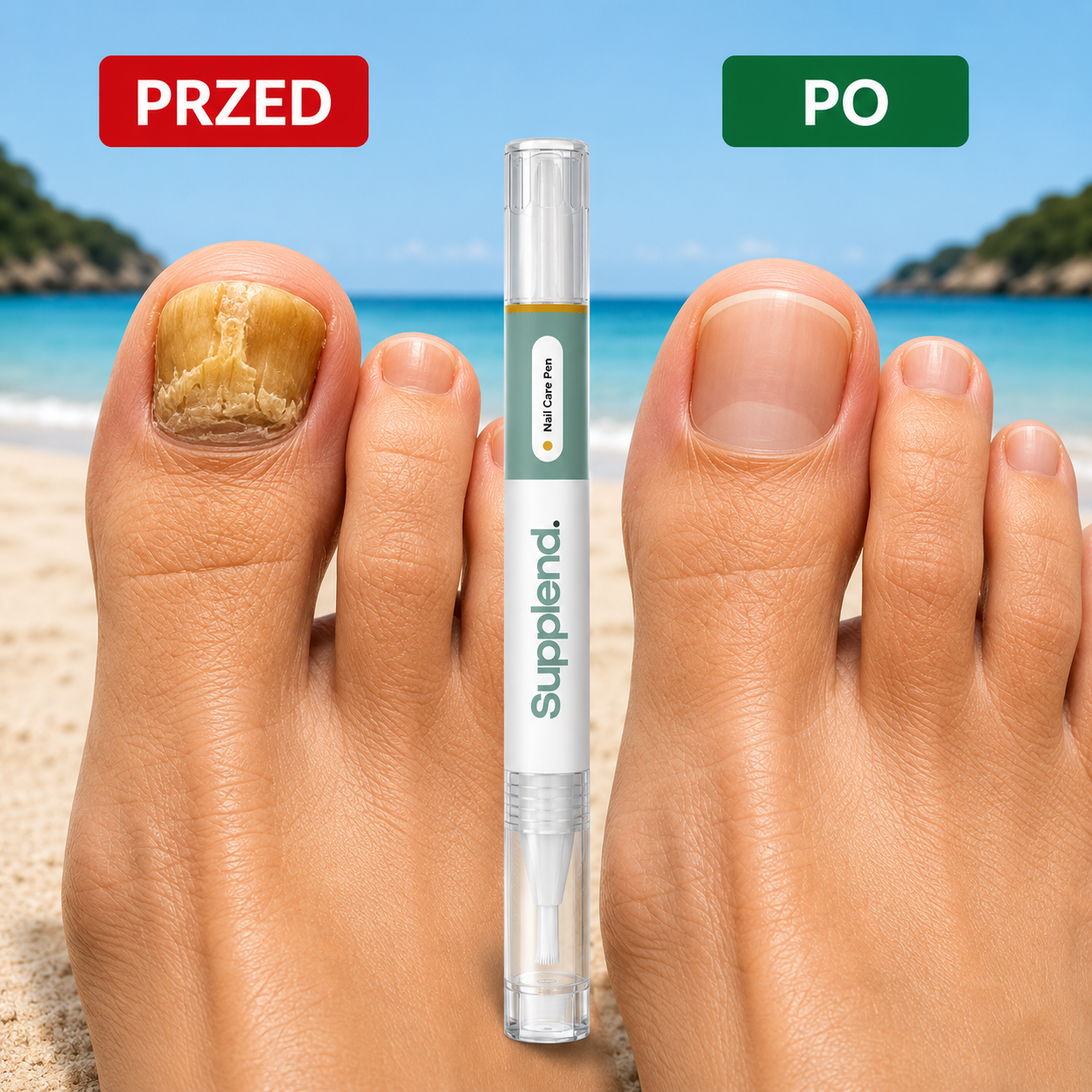 Supplend™ | Pożegnaj Grzybicę Paznokci I Odzyskaj Zdrowe, Piękne Paznokcie