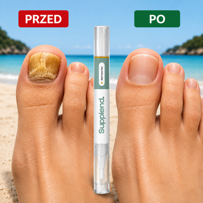 Supplend™ | Pożegnaj Grzybicę Paznokci I Odzyskaj Zdrowe, Piękne Paznokcie
