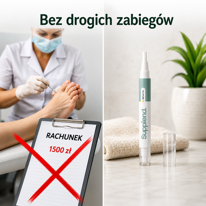 Supplend™ | Pożegnaj Grzybicę Paznokci I Odzyskaj Zdrowe, Piękne Paznokcie