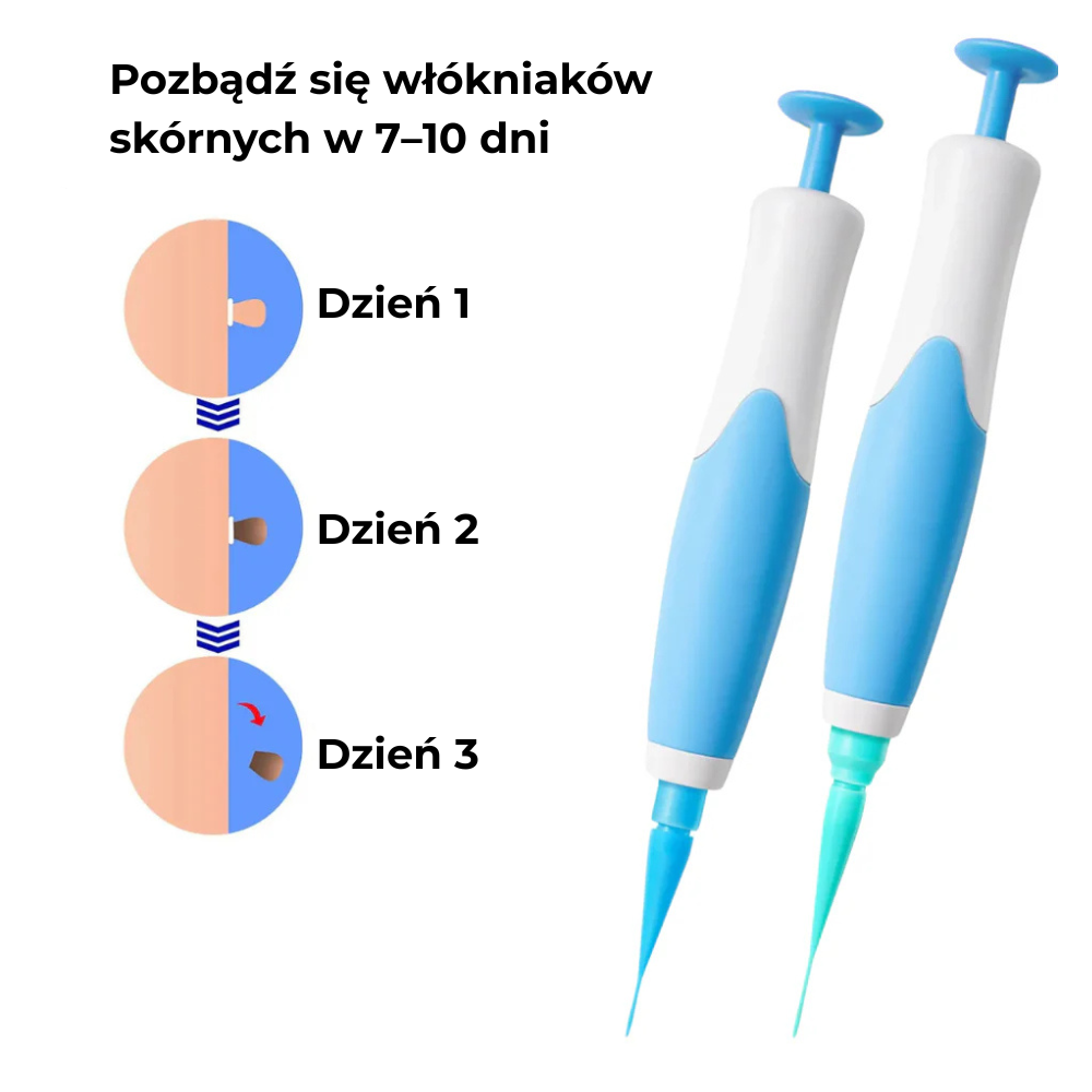ClearTag™ - Usuwa włókniaki skórne w 7–10 dni