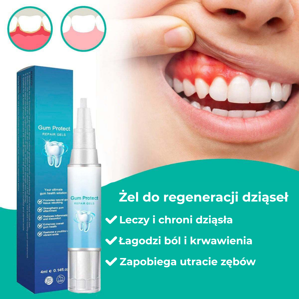 Teeth Repair Gel | Rewitalizuje dziąsła i wybiela zęby już w pierwszym tygodniu