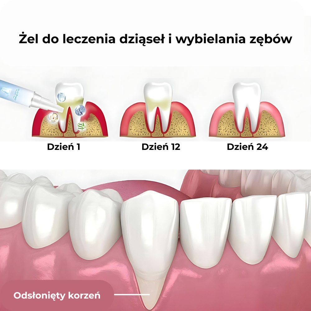 Teeth Repair Gel | Rewitalizuje dziąsła i wybiela zęby już w pierwszym tygodniu